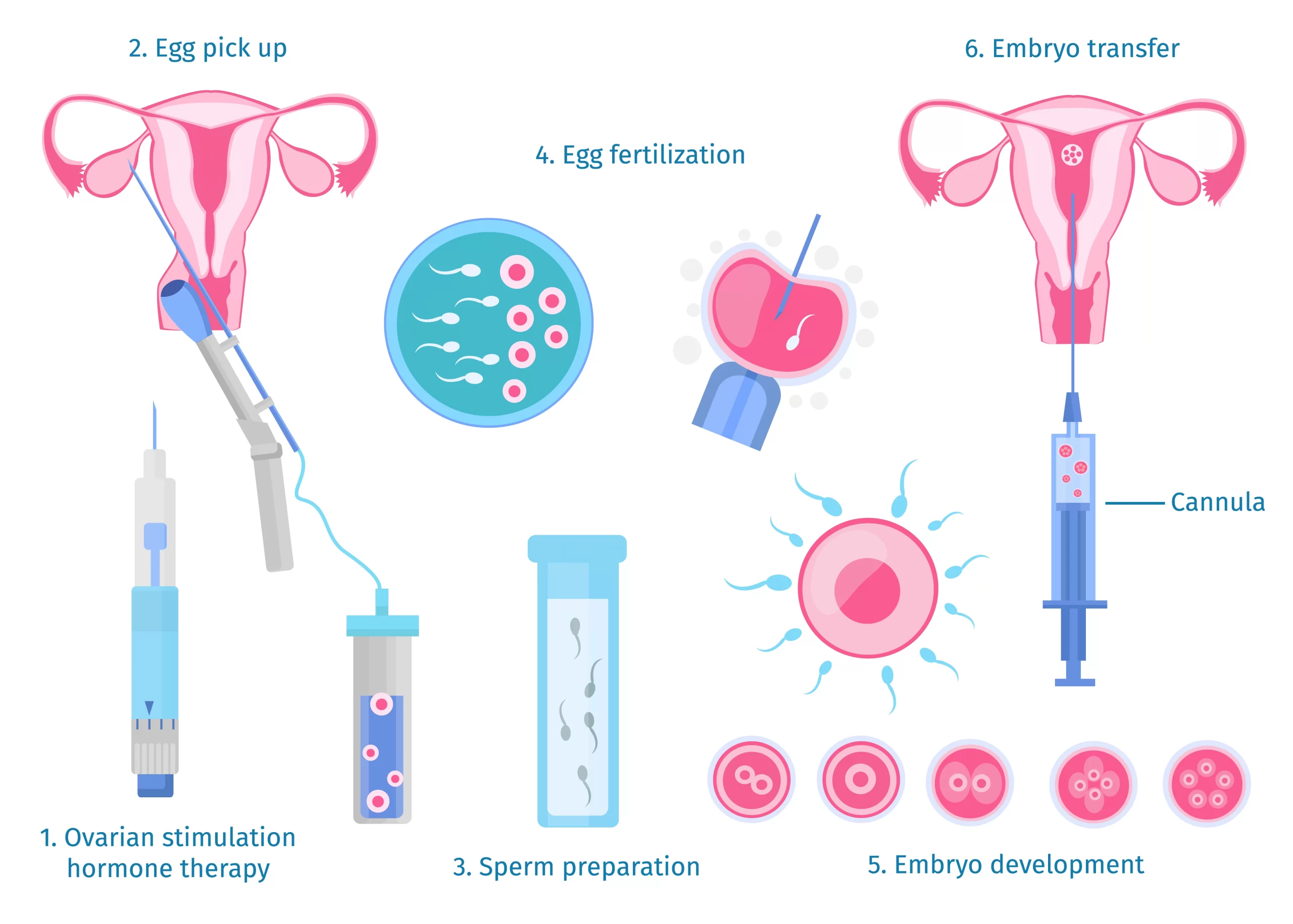 Anmol Fertility Clinic specializes in assisted reproductive techniques like IVF and associated infertility treatment in Jaipur and Best IVF center in Jaipur. We provide comprehensive treatment options for both male and female infertility problems, with caring emotional support to all our patients in a relaxed and friendly environment. Our Progressive Fine Tuning methodology doubles the chances of conception, bringing a beacon of hope to many couples who almost give up their dreams of having a child after repeated failures to cure infertility.