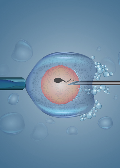 Assisted Laser Hatching